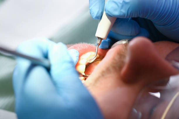 Best After-Hours Emergency Dentist in Greenvle, IL