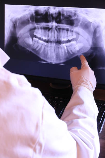 Best Emergency Dental Surgery in Greenvle, IL