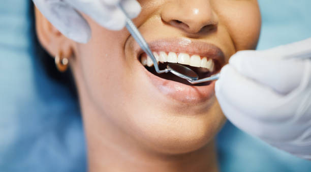 Best Emergency Tooth Extraction in Greenvle, IL
