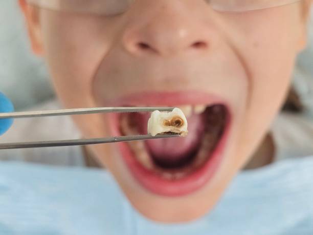 Best Emergency Treatment for Toothache in Greenvle, IL